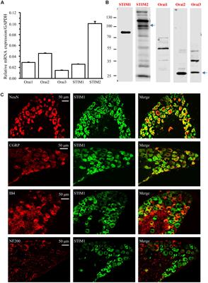 Orai1 and Orai3 Mediate Store-Operated Calcium Entry Contributing to Neuronal Excitability in Dorsal Root Ganglion Neurons